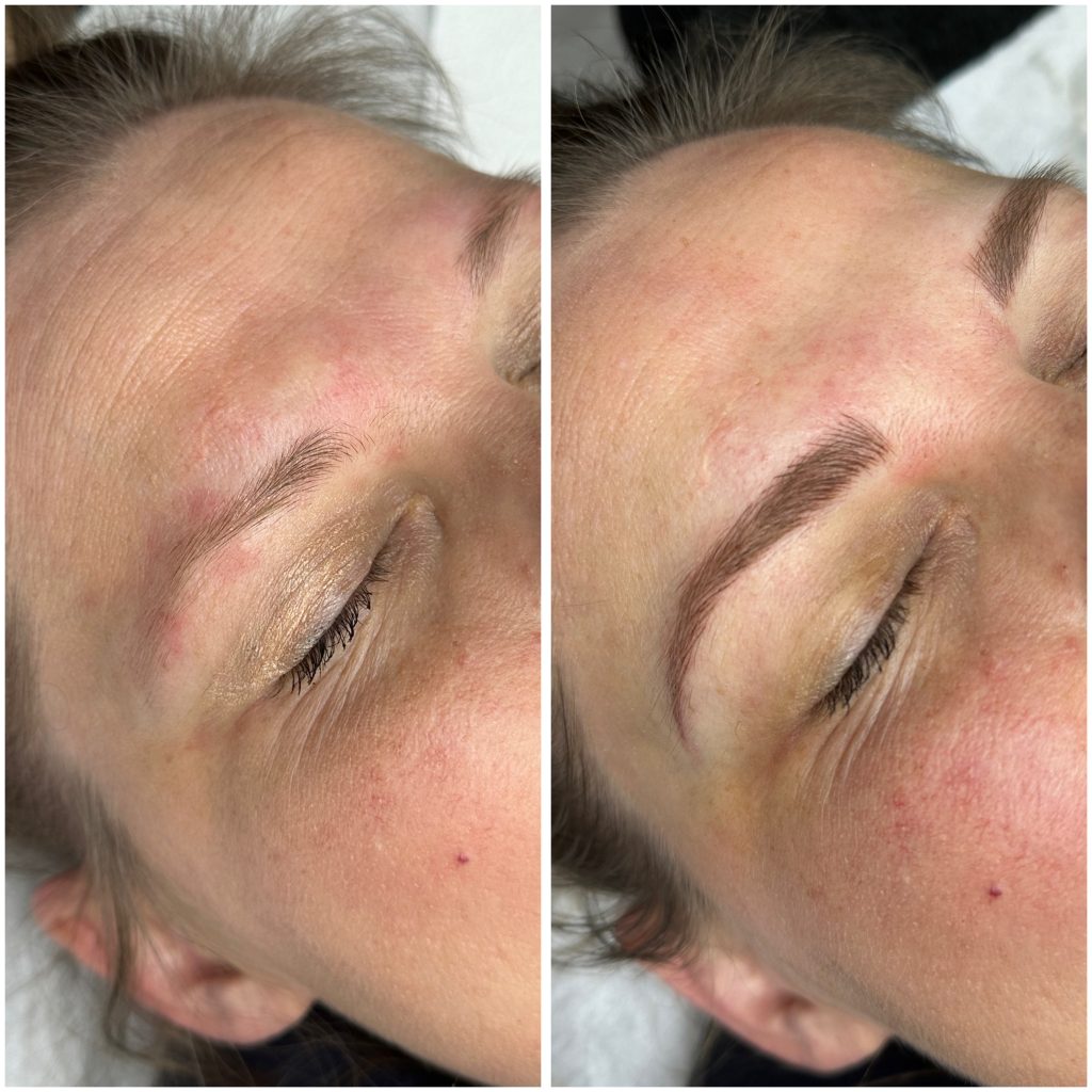 Face-forward-kilcock-permanent-makeup--0