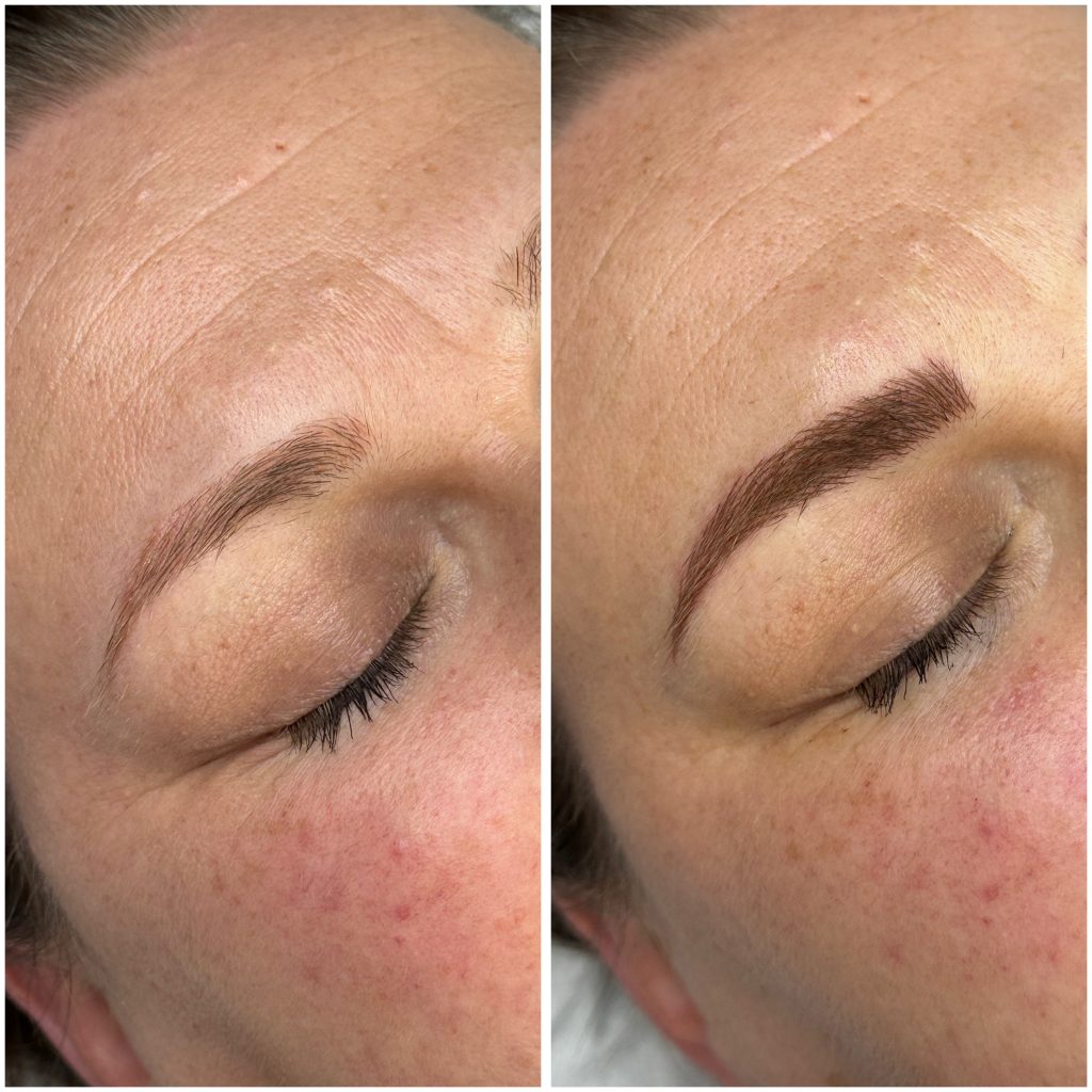 Face-forward-kilcock-permanent-makeup-00