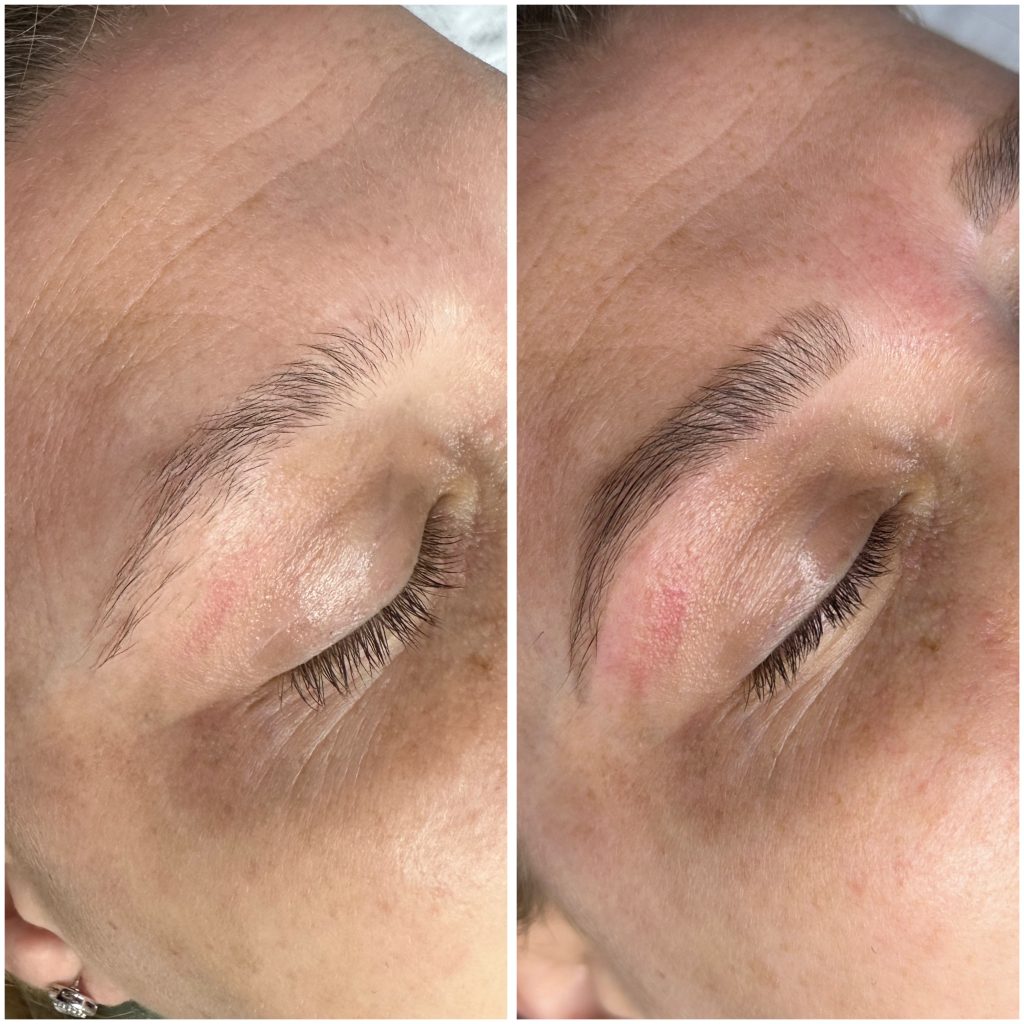 Face-forward-kilcock-permanent-makeupe0